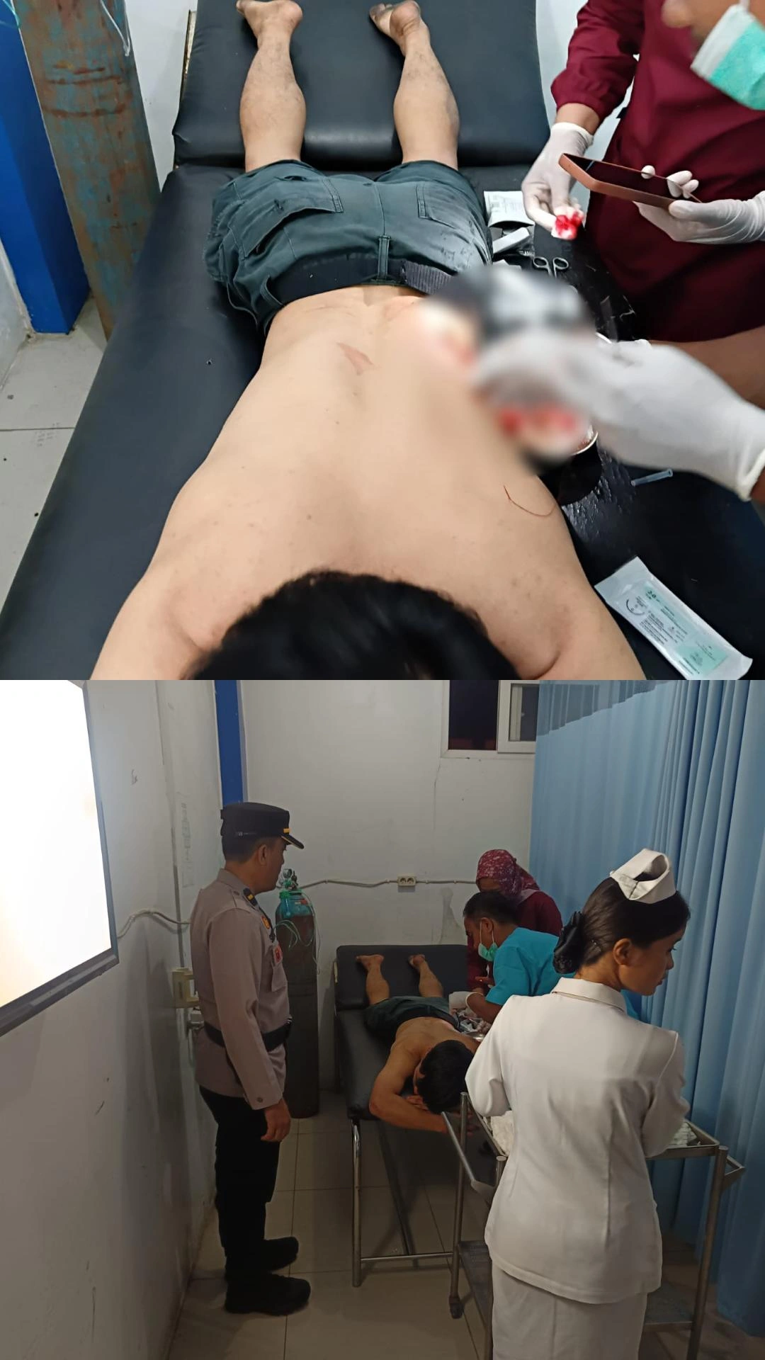 Ngeri! Teguran Berujung Maut, Pria di Wek II Dibacok Sekelompok Pemuda, Polisi Bergerak Cepat